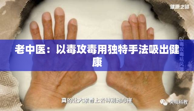 老中醫(yī)：以毒攻毒用獨(dú)特手法吸出健康