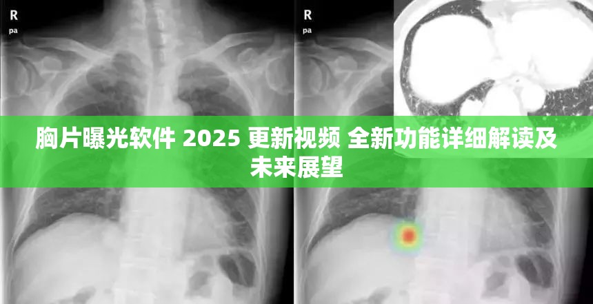 胸片曝光軟件 2025 更新視頻 全新功能詳細解讀及未來展望