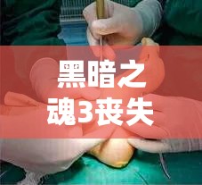 黑暗之魂3喪失石高效獲取攻略及游戲中資源管理策略探討