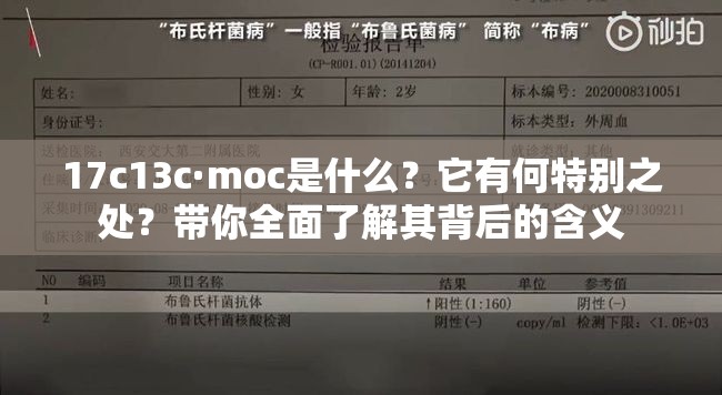 17c13c·moc是什么？它有何特別之處？帶你全面了解其背后的含義